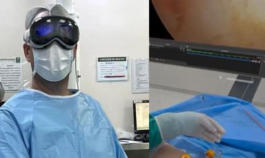 Một bác sĩ ở Brazil dùng Apple Vision Pro hỗ trợ phẫu thuật cho bệnh nhân bị rách cơ vai